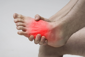 Treating a Lisfranc Injury